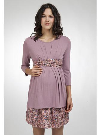 Туника Balloon-Paris