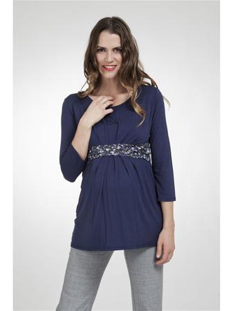 Туника Balloon-Paris