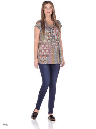 Туника 40 недель