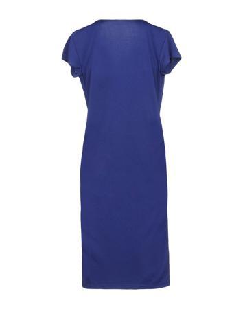 Платье FORNARINA