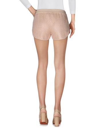 Шорты PATRIZIA PEPE Шорты PATRIZIA PEPE