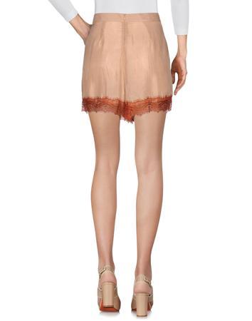 Шорты SCOTCH & SODA