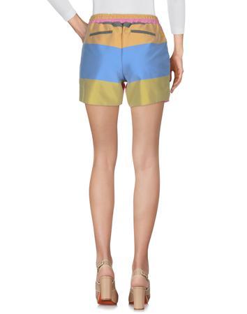 Шорты REVISE Шорты REVISE